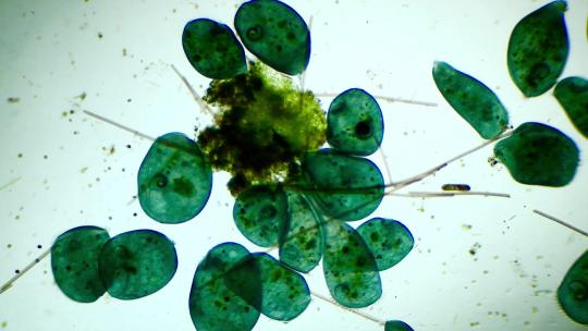 显微镜下放大40倍的一大群微生物喇叭虫（明场）