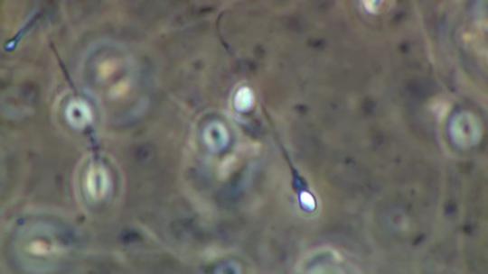 显微镜下的精子视频素材模板下载
