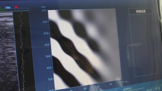 医院检验科室测量检查仪器屏幕参数值视频素材模板下载