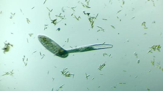 显微镜下放大100倍的微生物旋口虫