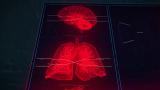 医学解剖HUD标志高科技技术动画高清AE视频素材下载