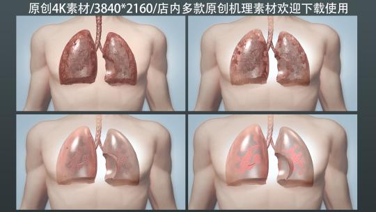 肺部恢复健康机理动画高清在线视频素材下载