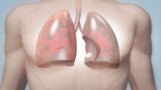 肺部恢复健康机理动画