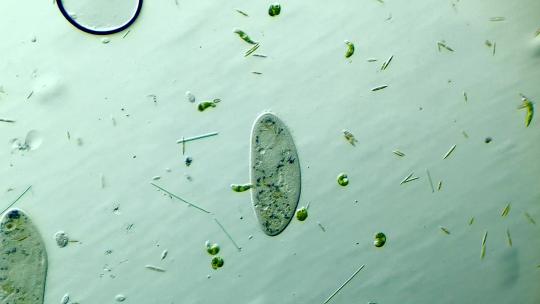 显微镜下放大100倍的微生物草履虫和眼虫