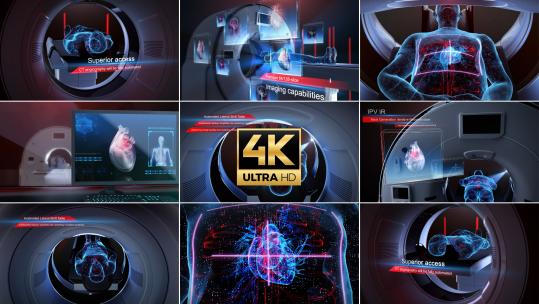 智慧医疗科技体检医院医生健康ct产业
