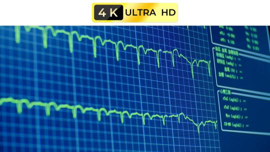 心电图实时监控