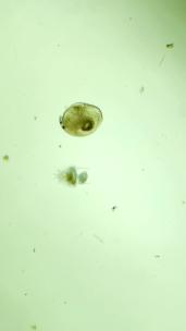 竖屏 显微镜下的水蚤与轮虫