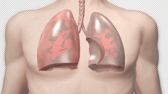【4K带透明通道】肺部恢复健康动画