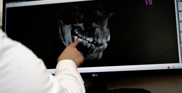 精品 · 口腔科医生正在给病人看牙片视频素材模板下载