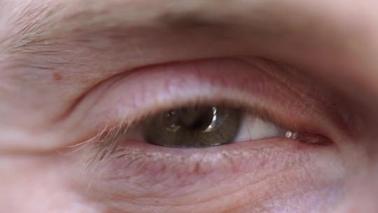 眼睛视力验光近视治疗视频素材模板下载
