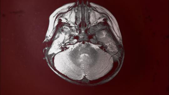 大脑断层扫描视频素材模板下载