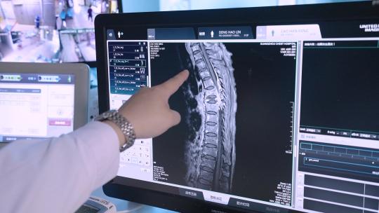 影像科 CT核磁共振视频素材模板下载