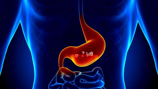 胃痛-胃酸动画胃胀胃病胃癌胃酸胃炎视频素材模板下载