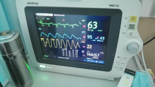 医院病房心电图血氧监控视频素材模板下载