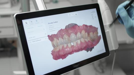 医生检查口腔牙齿3D模型！