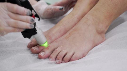 专业美容师为年轻女子的脚做激光脱毛的特写视频
