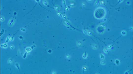 显微镜下的精子视频素材模板下载