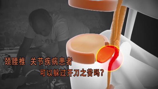 AE微创骨科片头4k模板