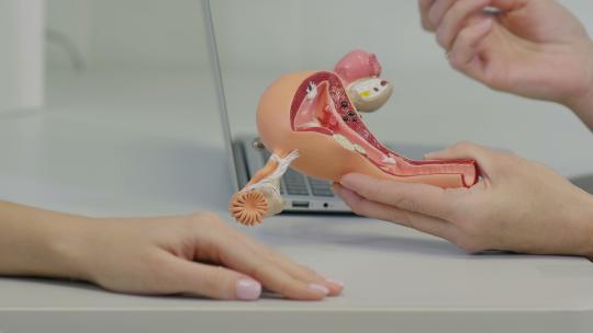 妇科医生使用子宫解剖模型咨询患者
