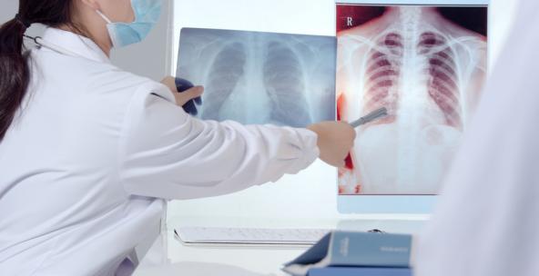 精品 · 医生对比讲解病人的肺部CT片