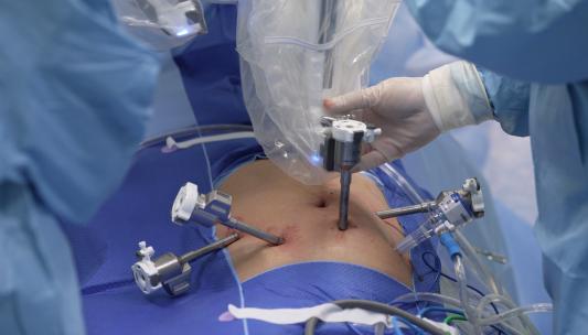 达芬奇手术  腹腔镜  机器人手术