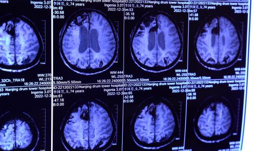 医院 病人挂号专家门诊老人看病看片子医生